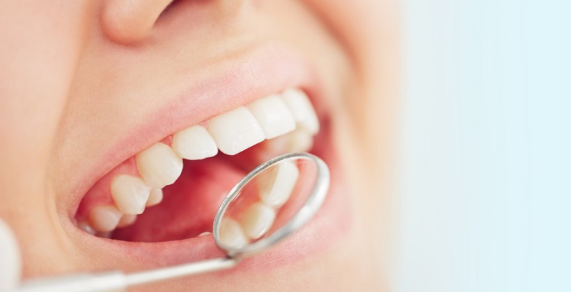 How to Prevent Dental Caries